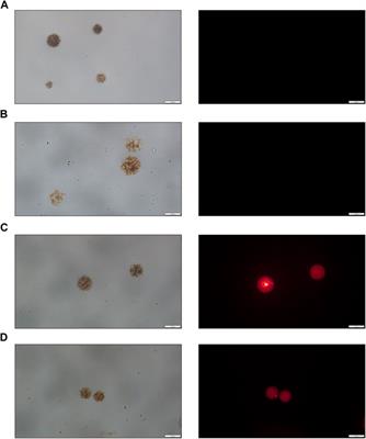 Magnetic-driven hydrogel microrobots for promoting osteosarcoma chemo-therapy with synthetic lethality strategy